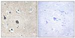 MID1 Antibody in Immunohistochemistry (Paraffin) (IHC (P))