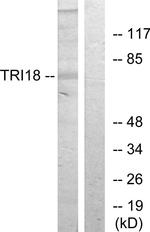 MID1 Antibody in Western Blot (WB)