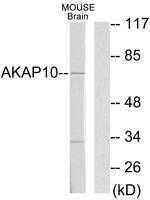 AKAP10 Antibody in Western Blot (WB)