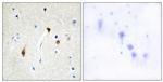 Hairless Antibody in Immunohistochemistry (Paraffin) (IHC (P))