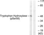 Phospho-TPH1 (Ser58) Antibody in Western Blot (WB)