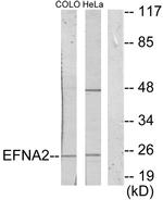 Ephrin A2 Antibody in Western Blot (WB)
