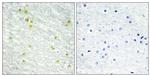 MED14 Antibody in Immunohistochemistry (Paraffin) (IHC (P))