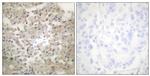 Phospho-TPH1 (Ser260) Antibody in Immunohistochemistry (Paraffin) (IHC (P))