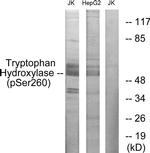 Phospho-TPH1 (Ser260) Antibody in Western Blot (WB)
