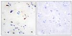 ZEB2 Antibody in Immunohistochemistry (Paraffin) (IHC (P))