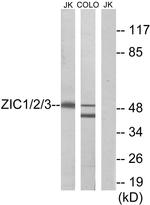 ZIC1/ZIC2/ZIC3 Antibody in Western Blot (WB)