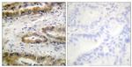 Phospho-VEGF Receptor 2 (Tyr1054) Antibody in Immunohistochemistry (Paraffin) (IHC (P))
