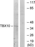 TBX10 Antibody in Western Blot (WB)