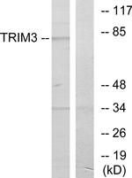 BERP Antibody in Western Blot (WB)