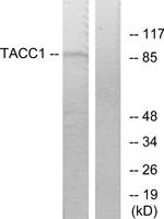 TACC1 Antibody in Western Blot (WB)