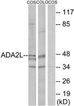 TADA2L Antibody in Western Blot (WB)