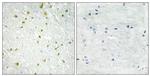 SNAPC5 Antibody in Immunohistochemistry (Paraffin) (IHC (P))