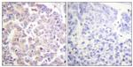 Phospho-APC1 (Ser688) Antibody in Immunohistochemistry (Paraffin) (IHC (P))