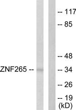 ZRANB2 Antibody in Western Blot (WB)
