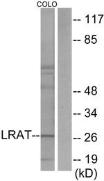 LRAT Antibody in Western Blot (WB)