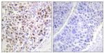 Phospho-Aurora B (Thr232) Antibody in Immunohistochemistry (Paraffin) (IHC (P))
