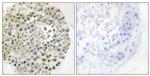TRIM16 Antibody in Immunohistochemistry (Paraffin) (IHC (P))
