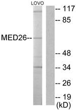 MED26 Antibody in Western Blot (WB)