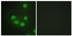 SIX6 Antibody in Immunocytochemistry (ICC/IF)