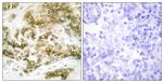 TBX15/TBX18 Antibody in Immunohistochemistry (Paraffin) (IHC (P))