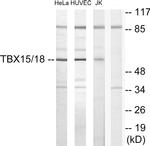 TBX15/TBX18 Antibody in Western Blot (WB)