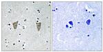 Phospho-KChIP3 (Ser63) Antibody in Immunohistochemistry (Paraffin) (IHC (P))