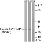 Phospho-KChIP3 (Ser63) Antibody in Western Blot (WB)