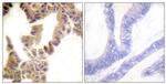 Phospho-Caspase 2 (Ser157) Antibody in Immunohistochemistry (Paraffin) (IHC (P))