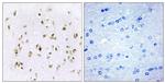 HMGN2 Antibody in Immunohistochemistry (Paraffin) (IHC (P))
