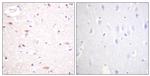 Phospho-APC6 (Ser560) Antibody in Immunohistochemistry (Paraffin) (IHC (P))
