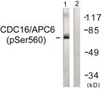 Phospho-APC6 (Ser560) Antibody in Western Blot (WB)