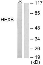 HEXB Antibody in Western Blot (WB)
