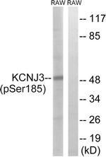 Phospho-Kir3.1 (Ser185) Antibody in Western Blot (WB)