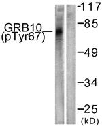 Phospho-GRB10 (Tyr67) Antibody in Western Blot (WB)