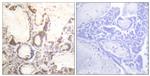 Phospho-RACGAP1 (Ser387) Antibody in Immunohistochemistry (Paraffin) (IHC (P))