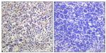 HBP1 Antibody in Immunohistochemistry (Paraffin) (IHC (P))