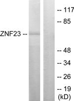ZNF23 Antibody in Western Blot (WB)