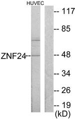 ZNF24 Antibody in Western Blot (WB)
