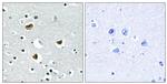 HMGN2 Antibody in Immunohistochemistry (Paraffin) (IHC (P))