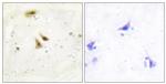 UBF-1 Antibody in Immunohistochemistry (Paraffin) (IHC (P))