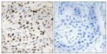 Phospho-HMGN1 (Ser21) Antibody in Immunohistochemistry (Paraffin) (IHC (P))