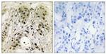 HMGN1 Antibody in Immunohistochemistry (Paraffin) (IHC (P))