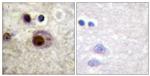 Phospho-hnRNP C (Ser260) Antibody in Immunohistochemistry (Paraffin) (IHC (P))