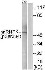 Phospho-hnRNP K (Ser284) Antibody in Western Blot (WB)