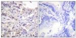 Phospho-hnRNP D (Ser83) Antibody in Immunohistochemistry (Paraffin) (IHC (P))