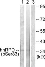 Phospho-hnRNP D (Ser83) Antibody in Western Blot (WB)