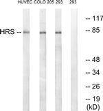 HGS Antibody in Western Blot (WB)
