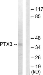 PTX3 Antibody in Western Blot (WB)