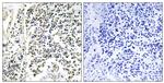 Phospho-IkB alpha (Tyr305) Antibody in Immunohistochemistry (Paraffin) (IHC (P))